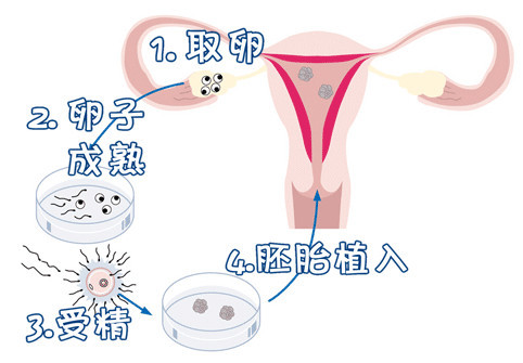 着床障害